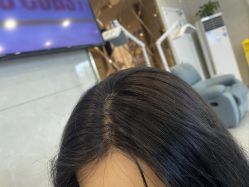 -碧莲盛·不剃发植发