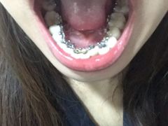 -浙江大学医学院附属口腔医院湖滨（延安）院区