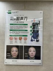 点击看大图 -深圳鹏爱秀琪医疗美容医院