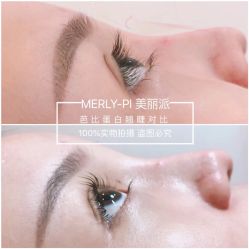 -MLP美丽派·问题肌疗愈中心