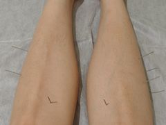 -承启堂中医馆·推拿·针灸·把脉(青羊馆)