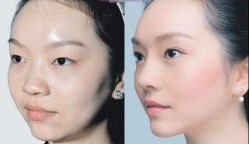 -SKINIST丽铂医疗美容