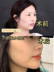 -上海伊莱美医疗美容医院