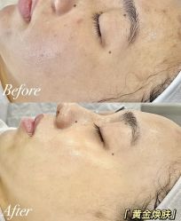 -Cream88颜皮肤管理中心