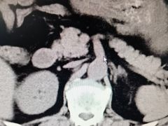 -上海市普陀区中心医院