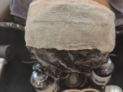 -碧莲盛·不剃发植发