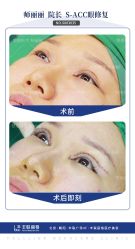 -丰联丽格医疗美容·联合丽格眼整形中心