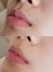 -Cream88颜皮肤管理中心