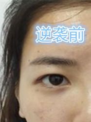 -美莱医学美容医院