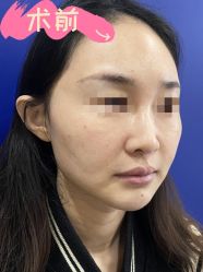 -素美医疗美容·西南眼鼻整形·修复基地