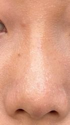 体验后-深圳美莱医疗美容医院