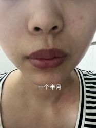 点击看大图 -广州紫馨整形外科医院
