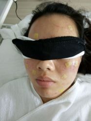 -苗方清颜专业祛痘