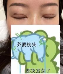 -成都西区医院整形美容