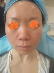 体验前-上海玫瑰医疗美容医院