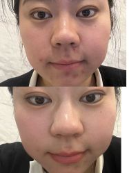 -王妃SPA·美容·科技抗衰
