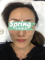 体验前-坤如玛丽·医疗美容中心