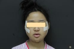 -圣嘉新医疗美容医院