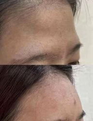 -天津健丽·去眼袋医疗美容机构