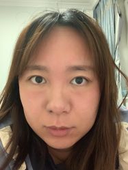 体验后-亿美医疗美容·半岛大超炮官方授权店