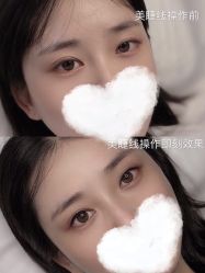 -YIMEI ART半永久纹眉·野生眉