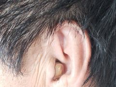 -安湃声助听器(密云店)