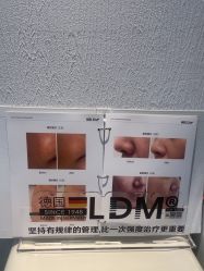 -小梨·OndaPro·专业脱毛连锁机构
