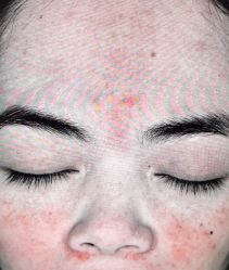 -厦门美莱整形美容医院