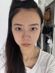 -广州健丽·去眼袋医疗美容机构