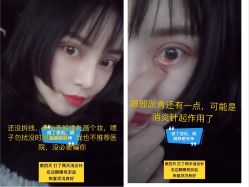 点击看大图 -禾丽康美医疗美容医院