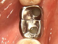 -精德口腔·种植修复·儿牙中心(财富中心店)