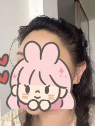 -碧莲盛·不剃发植发