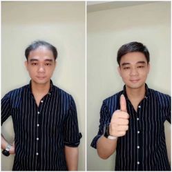 -发饰美男士增发补发假发定制店