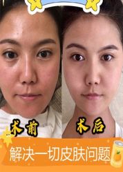 点击看大图 -AIST爱思特医疗美容医院