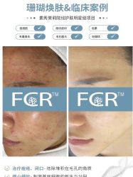 -苗方清颜痘肌研究所