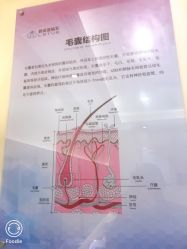 -碧莲盛·不剃发植发