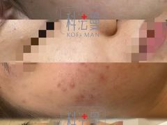 -上置·美兰优湖