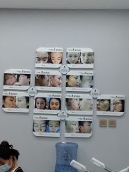 -悟空祛痘·诺奖技术专业店