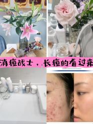 -靓芙泉祛痘.科技美肤连锁
