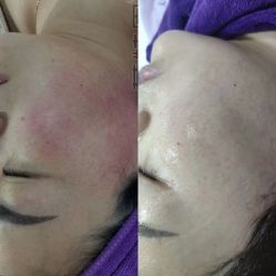 -蕾特恩专业祛痘·皮肤管理