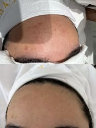 -康美贞·痘肌养护管理中心