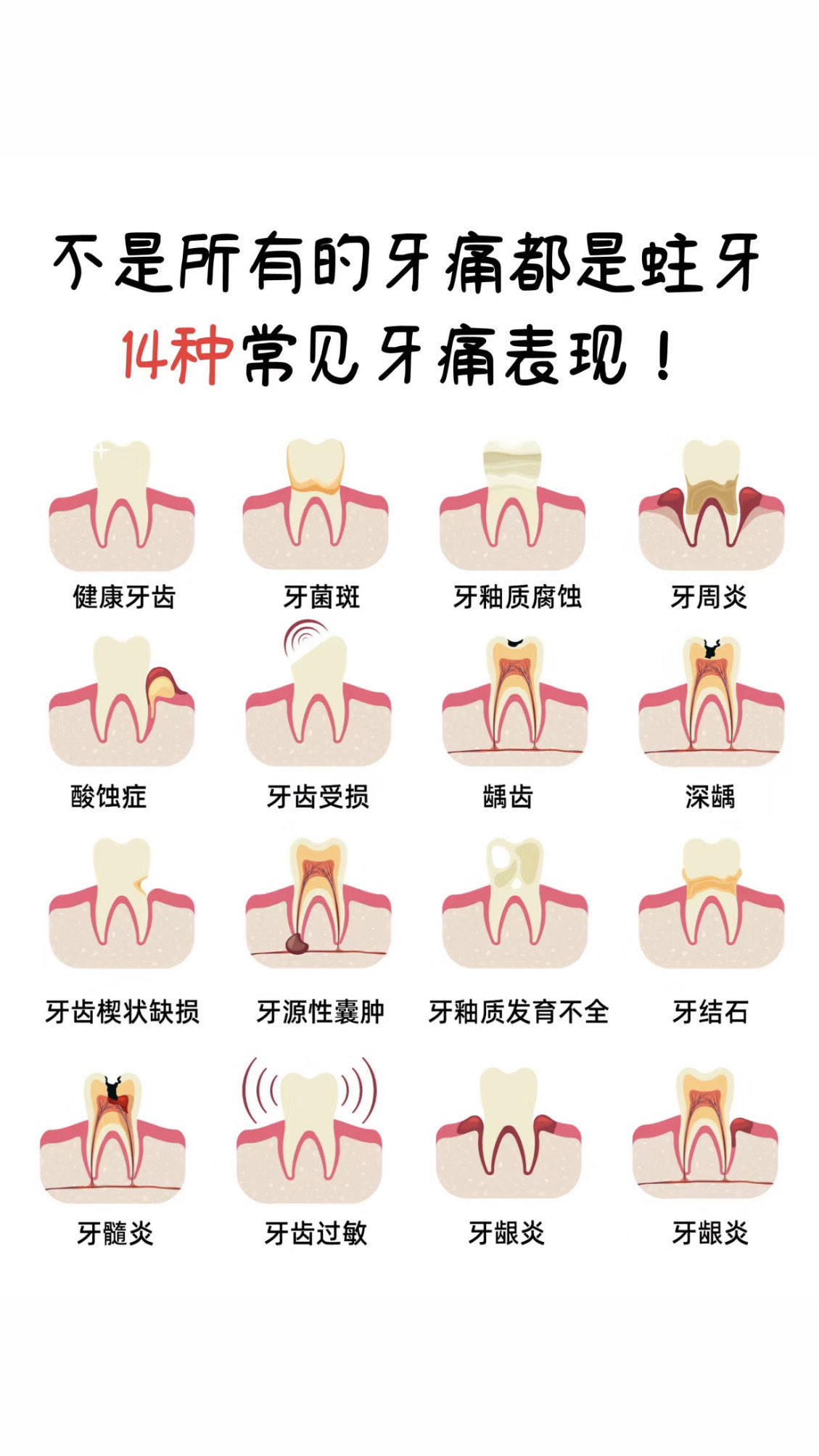 种牙疼吗需要多长时间图片