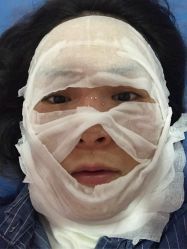 -郑州米兰柏羽集美医疗美容医院