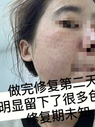 -海涛医疗美容·面部抗衰·注射美鼻