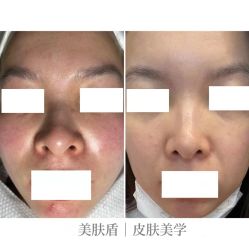 -美肤盾祛痘·问题肌头疗管理中心