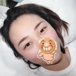 点击看大图 -郡艺医疗美容·微整·眼鼻吸脂