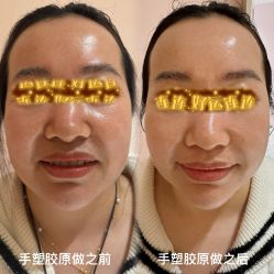 -水仙美肌面部护理美容馆