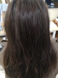 -碧莲盛·不剃发植发