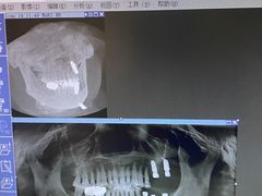 -极光口腔·矫正种植修复(锦江店)