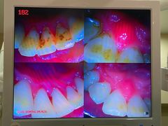 -土豆口腔(凤凰北总店)